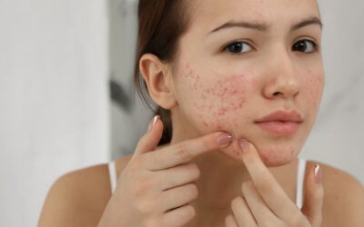 Kamilla illóolaj: hatások, alkalmazás és receptek bőrproblémák esetén